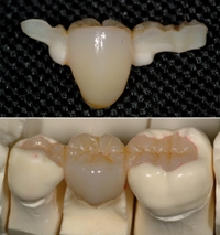 dental fiber technology dental fiber technology