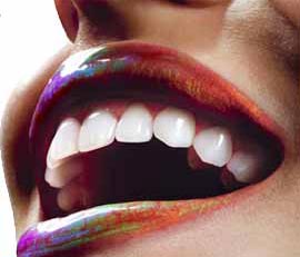 teeth whitening