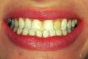 cosmetic dentistry