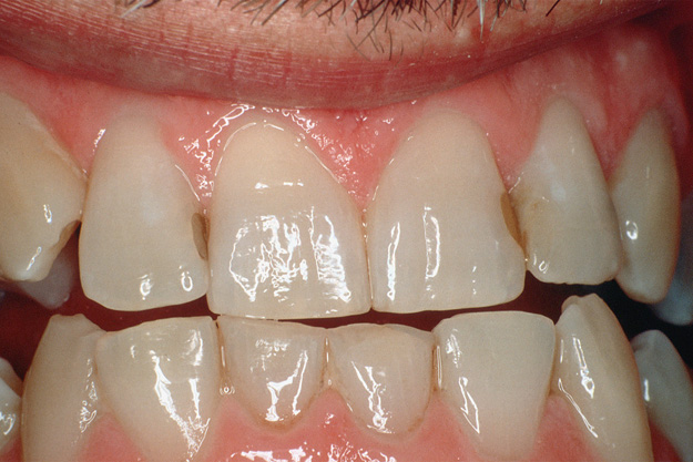 cosmetic dentistry