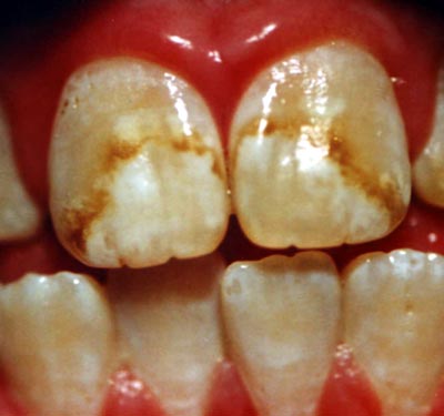 cosmetic dentistry