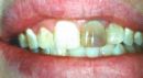 cosmetic dentistry
