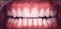 cosmetic dentistry