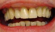 cosmetic dentistry cosmetic dentistry