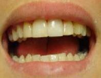 cosmetic dentistry cosmetic dentistry