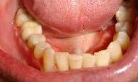 cosmetic dentistry cosmetic dentistry