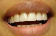cosmetic dentistry cosmetic dentistry