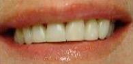cosmetic dentistry cosmetic dentistry