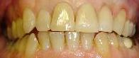 cosmetic dentistry cosmetic dentistry
