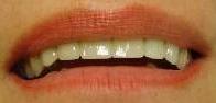 cosmetic dentistry cosmetic dentistry