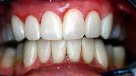 cosmetic dentistry cosmetic dentistry