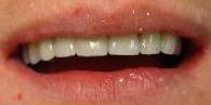 cosmetic dentistry cosmetic dentistry
