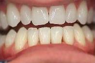 cosmetic dentistry cosmetic dentistry