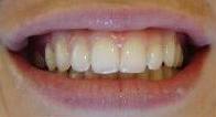 cosmetic dentistry cosmetic dentistry
