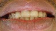 cosmetic dentistry cosmetic dentistry