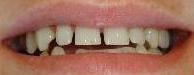 cosmetic dentistry cosmetic dentistry