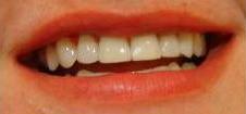 cosmetic dentistry cosmetic dentistry