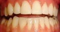 cosmetic dentistry cosmetic dentistry