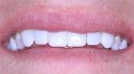 cosmetic dentistry cosmetic dentistry