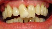 cosmetic dentistry cosmetic dentistry
