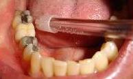 cosmetic dentistry cosmetic dentistry