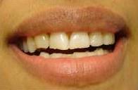 cosmetic dentistry cosmetic dentistry