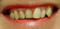 cosmetic dentistry cosmetic dentistry