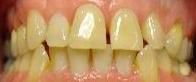 cosmetic dentistry cosmetic dentistry