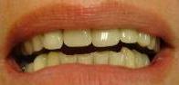 cosmetic dentistry cosmetic dentistry