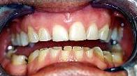 cosmetic dentistry cosmetic dentistry