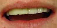 cosmetic dentistry cosmetic dentistry