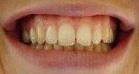 cosmetic dentistry cosmetic dentistry