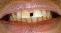 cosmetic dentistry cosmetic dentistry