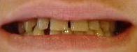 cosmetic dentistry cosmetic dentistry