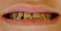 cosmetic dentistry cosmetic dentistry