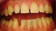 cosmetic dentistry cosmetic dentistry