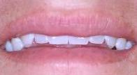 cosmetic dentistry cosmetic dentistry
